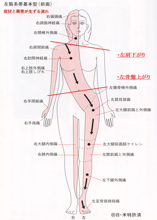 左筋系帯