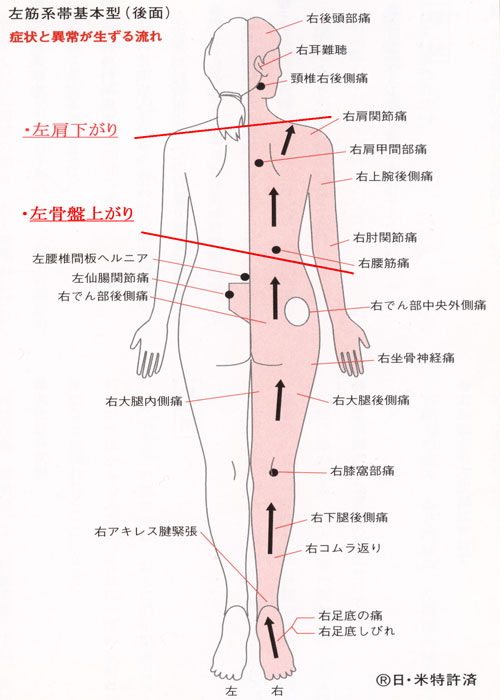 右 骨盤 近く の 痛み