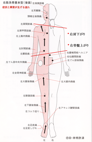 右 骨盤 近く の 痛み